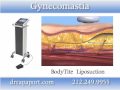 Gynecomastia New York - Plastic Surgeon Manhattan ...