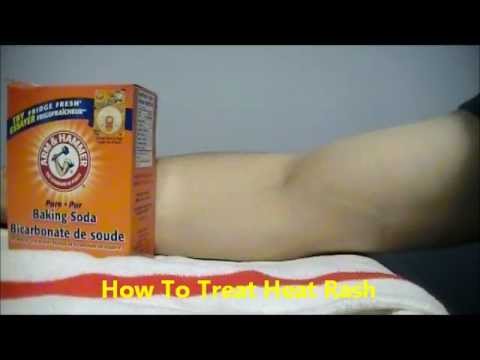 how to treat underarm rash