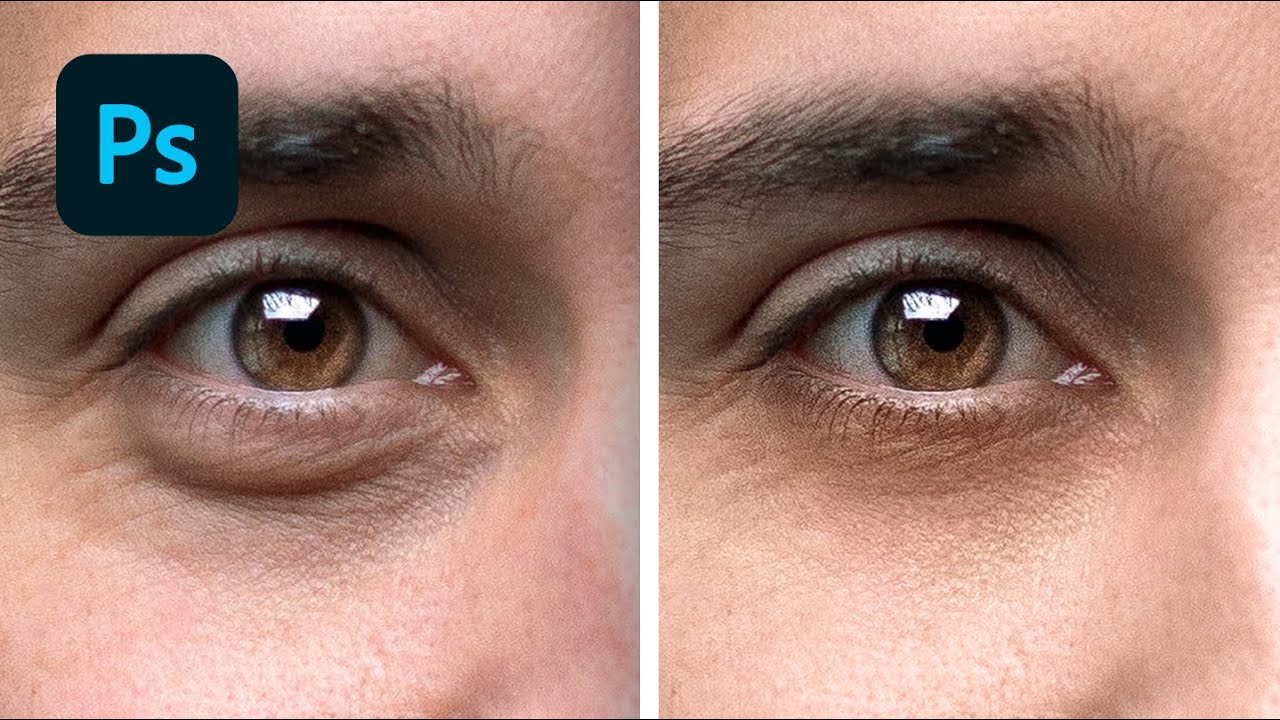 How To Remove Eye bags in Photoshop