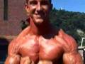 Muscular Veins like Snakes