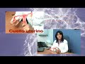 Vacuna para Virus de Papiloma Humano (VPH)