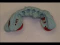 mini-dental-implants-dr-todd-shatkin-and-tooth-grinding.html