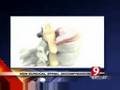 herniated disc treatment option video