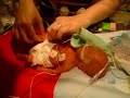 Preemie Diaper Change - Utah