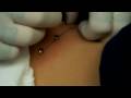 6 Dermal Anchors | Hip Piercings | Permanent Piercings | Part 1 W/ Huge Needle 6 Dermal Anchors | Hip Piercings | Permanent Piercings | Part 1 W/ Huge Needle