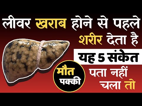 लीवर खराब होने से पहले देते हैं यह 5 संकेत, पता नहीं तो घातक | Liver Kharab hone ke lakshan