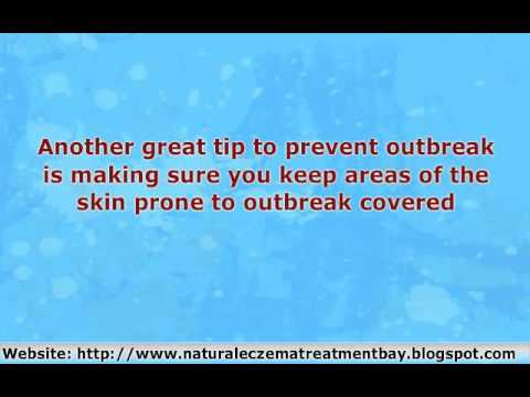 how to get rid of baby eczema