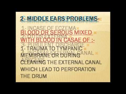 how to relieve otorrhoea