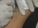 Cadar tattoo