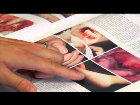 how to treat hfmd in babies