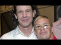 Down syndrome:&nbsp;Down Syndrome: What will happen to Andy?