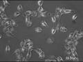 Cast of 1000 Proteins Shines in Movies of Cancer Cells