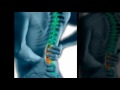 North Dallas, TX Back Pain Relief
