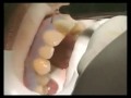 Darci Fischer Gets Tooth Whitening by Dr. Kourosh Maddahi