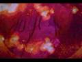 Everything In Its Right Place Video