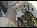Shockwave Treatment