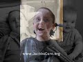 Canavan Disease