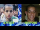 Antes e Depois I - Jovens da Igreja em VCA