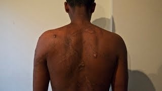 Egypt/Sudan: Traffickers Who Torture