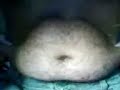 Hairy Flab
