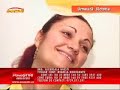 28 old amputee girl