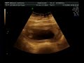 Eco Doppler 01.12.08