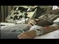 Leukaemia/BMT 10: Donating Bone Marrow