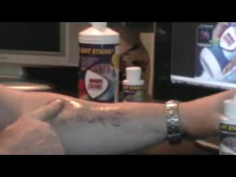how to remove a sharpie from skin