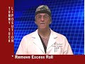 Dr. Thomas P. Trevisani, Explaining Tummy Tuck Dr. Thomas P. Trevisani, Explaining Tummy Tuck