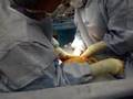 My-Twins-being-born-