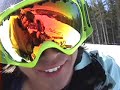 Landis Tanaka breaks collar bone :(