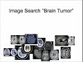 show me whats wrong inside: making 3d medical data accessible to everyone