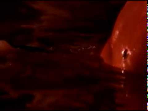 Ver video