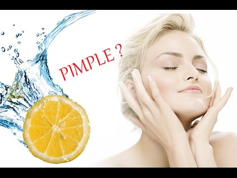 how to use lemon juice to get rid of acne