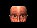 Click to View : botox 3d
