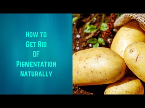 video-linktoworks-How to Get Rid of Pigmentation /Home Remedy/Dark...