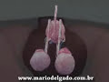 Cirurgia de Vasectomia Cirurgia de Vasectomia