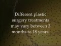 Treacher Collins Syndrome