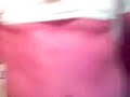 shot with ballbearing gun shot with ballbearing gun
