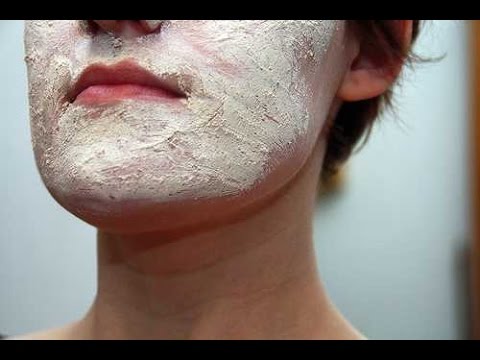 how to treat rash on face