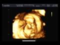 15 week ultrasound in 3D/4D & gender ID