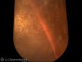 Bubbles blown in peal swirl @ 500fps.