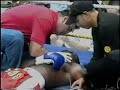 Knockdown Teddie