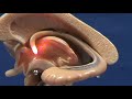 Brain Stem Model - Corpus Callosum & Hippocampus