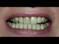 Cosmetic Dentistry solutions Cosmetic Dentistry solutions