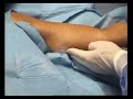 AdvancedAesthetics_LooseArm_Laserlipolisis