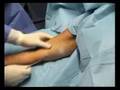 AdvancedAesthetics_LooseArm_Laserlipolisis