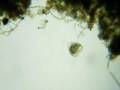 videos de Zoologia Dos Invertebrados - Vorticella
