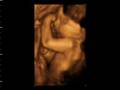 Robyn's 1st Video:) (4D Ultrasound)