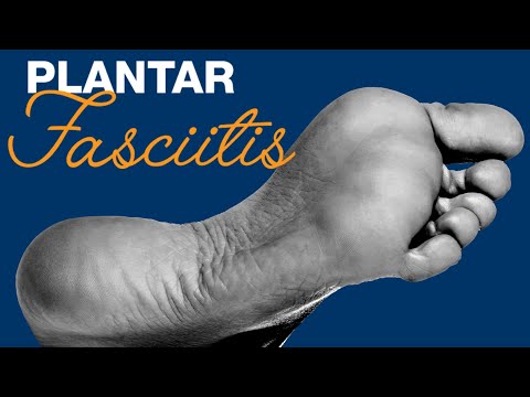 how to treat plantar fasciitis
